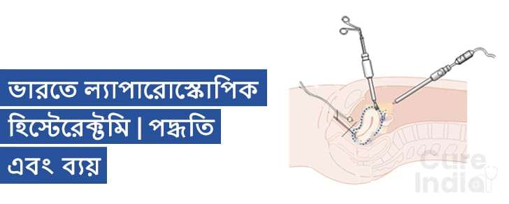 ল্যাপারোস্কোপিক হিস্টেরেক্টমি